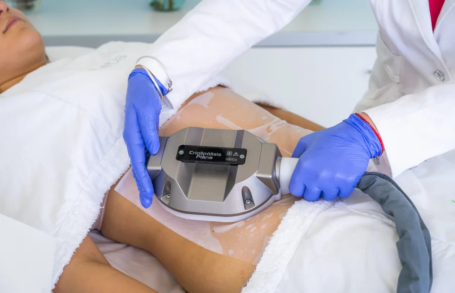 Secretos de Criolipólisis